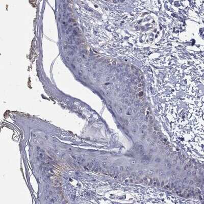 Immunohistochemistry-Paraffin: SLC4A10 Antibody [NBP3-17116]