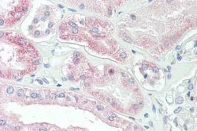 Immunohistochemistry-Paraffin: SLC4A11 Antibody [NBP1-46156]