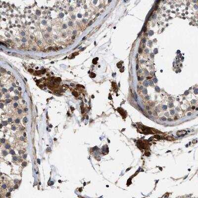 Immunohistochemistry-Paraffin: SLC4A11 Antibody [NBP1-88514]