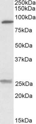 Western Blot: SLC4A11 Antibody [NBP1-46156]