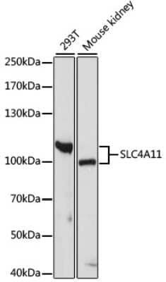 Western Blot: SLC4A11 AntibodyAzide and BSA Free [NBP2-94372]