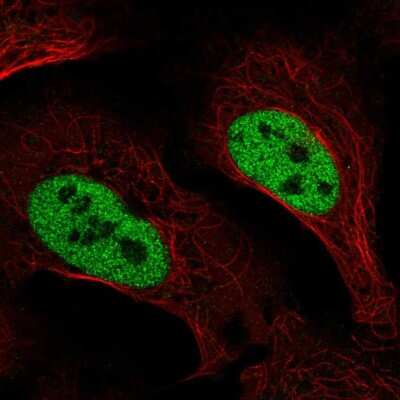 Immunocytochemistry/ Immunofluorescence: SLC4A3 Antibody [NBP2-56348]