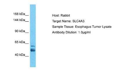 Western Blot: SLC4A3 Antibody [NBP2-83556]