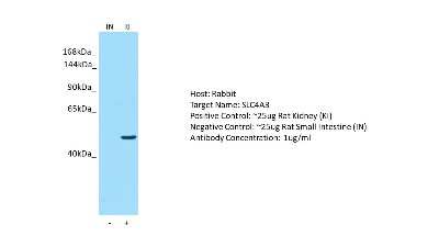 Western Blot: SLC4A3 Antibody [NBP2-83556]