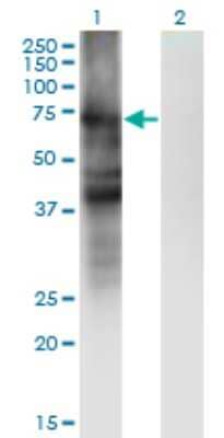 Western Blot: SLC4A4 Antibody (1G2) [H00008671-M01]