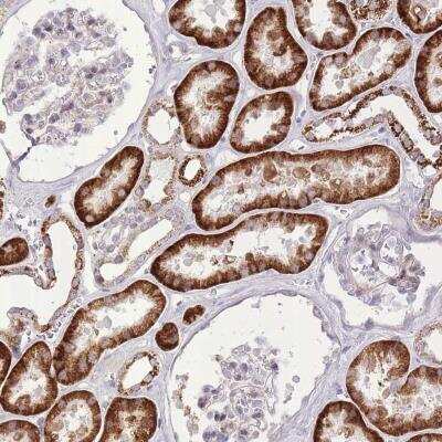 Immunohistochemistry-Paraffin: SLC4A4 Antibody [NBP2-32021]