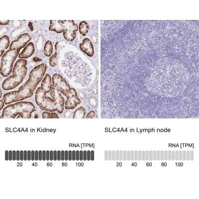 Immunohistochemistry-Paraffin: SLC4A4 Antibody [NBP2-32020]