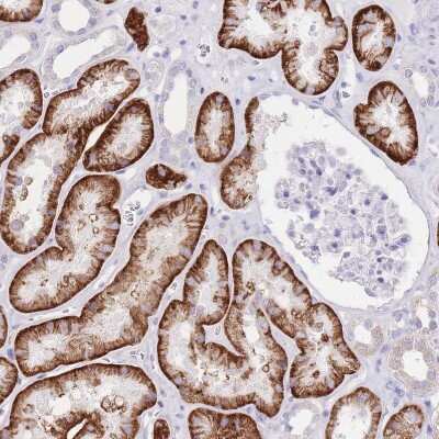 Immunohistochemistry-Paraffin: SLC4A4 Antibody [NBP2-32020]