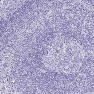 Immunohistochemistry-Paraffin: SLC4A4 Antibody [NBP2-32020]