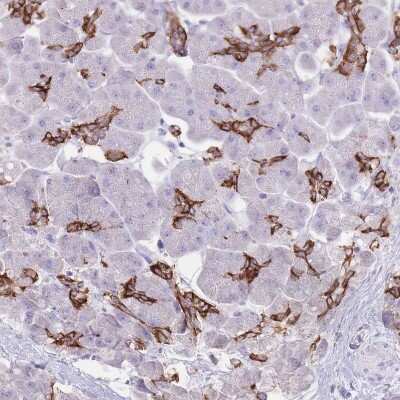 Immunohistochemistry-Paraffin: SLC4A4 Antibody [NBP2-32020]