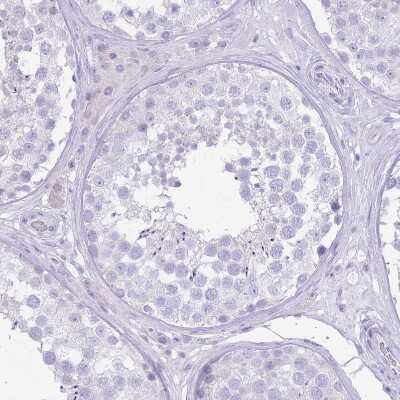 Immunohistochemistry-Paraffin: SLC4A4 Antibody [NBP2-32020]
