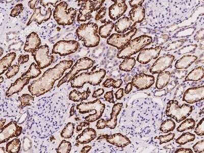 Immunohistochemistry-Paraffin: SLC4A4 Antibody [NBP2-98469]