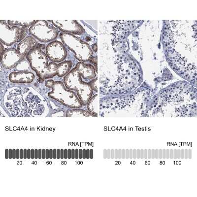 Immunohistochemistry-Paraffin: SLC4A4 Antibody [NBP3-17023]