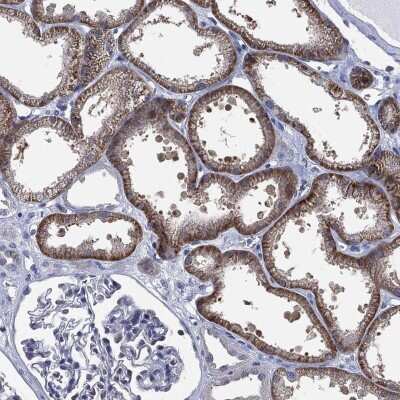 Immunohistochemistry-Paraffin: SLC4A4 Antibody [NBP3-17023]