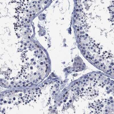Immunohistochemistry-Paraffin: SLC4A4 Antibody [NBP3-17023]
