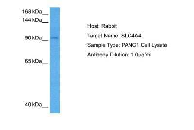 Western Blot: SLC4A4 Antibody [NBP2-88308]