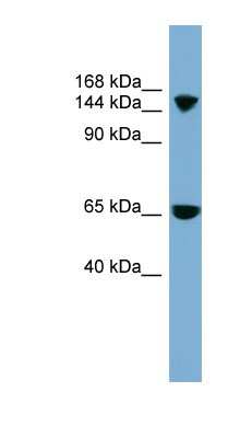 Western Blot: SLC4A5 Antibody [NBP1-59528]