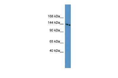 Western Blot: SLC4A5 Antibody [NBP2-84267]