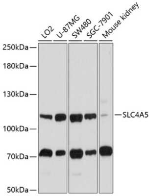 Western Blot: SLC4A5 AntibodyBSA Free [NBP2-93493]