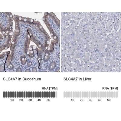 Immunohistochemistry-Paraffin: SLC4A7/Sodium bicarbonate cotransporter 3 Antibody [NBP1-87850]