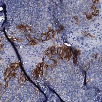 Immunohistochemistry-Paraffin: SLC4A7/Sodium bicarbonate cotransporter 3 Antibody [NBP1-87850]