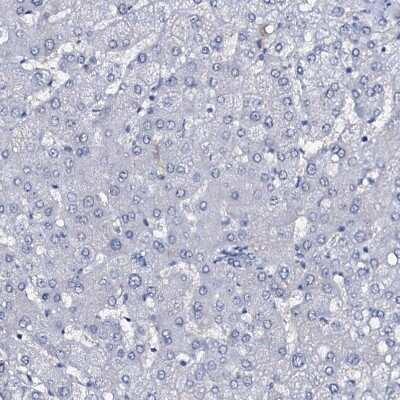Immunohistochemistry-Paraffin: SLC4A7/Sodium bicarbonate cotransporter 3 Antibody [NBP1-87850]