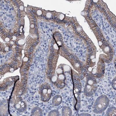 Immunohistochemistry-Paraffin: SLC4A7/Sodium bicarbonate cotransporter 3 Antibody [NBP1-87850]