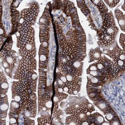 Immunohistochemistry-Paraffin: SLC4A7/Sodium bicarbonate cotransporter 3 Antibody [NBP1-87850]