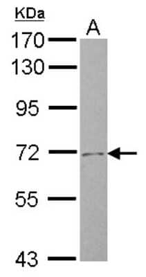 Western Blot: SLC4A8 Antibody [NBP2-20395]