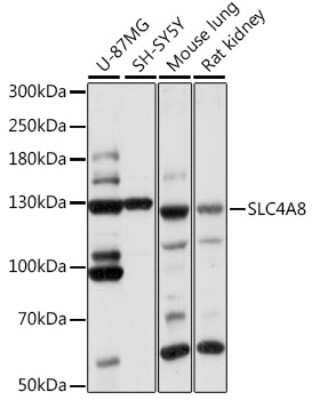 Western Blot: SLC4A8 AntibodyAzide and BSA Free [NBP2-93900]