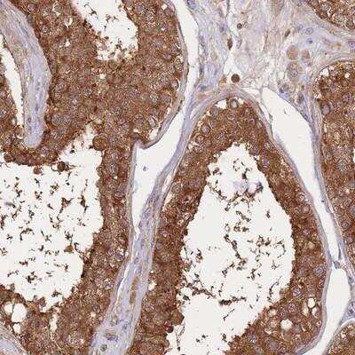 Immunohistochemistry-Paraffin: SLC4A9 Antibody [NBP2-13340]