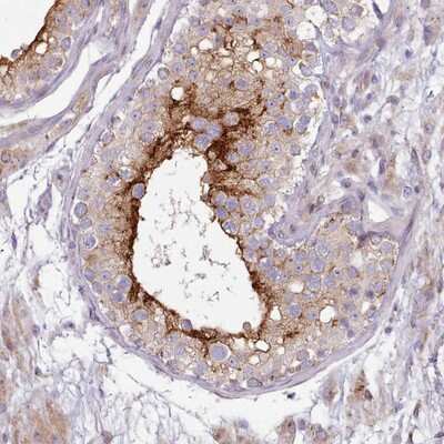 Immunohistochemistry-Paraffin: SLC52A3 Antibody [NBP2-14683]