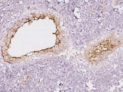 Immunohistochemistry-Paraffin: SLC52A3 Antibody [NBP2-98481]