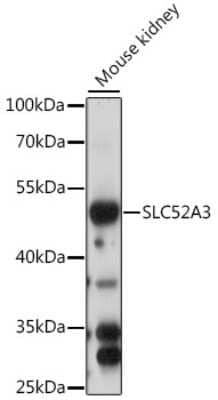 Western Blot: SLC52A3 AntibodyAzide and BSA Free [NBP2-94430]