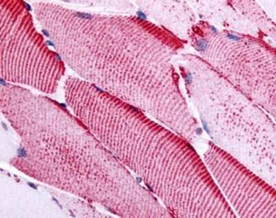 Immunohistochemistry-Paraffin: SLC5A10 Antibody - BSA Free [NB110-40437]