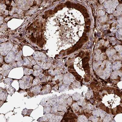 Immunohistochemistry-Paraffin: SLC5A10 Antibody [NBP2-13341]