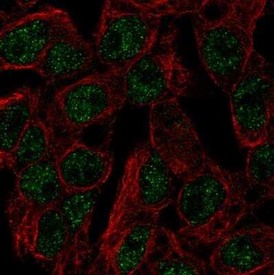 Immunocytochemistry/ Immunofluorescence: SLC5A11 Antibody [NBP1-82862]