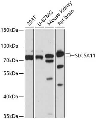 Western Blot: SLC5A11 AntibodyAzide and BSA Free [NBP2-93586]