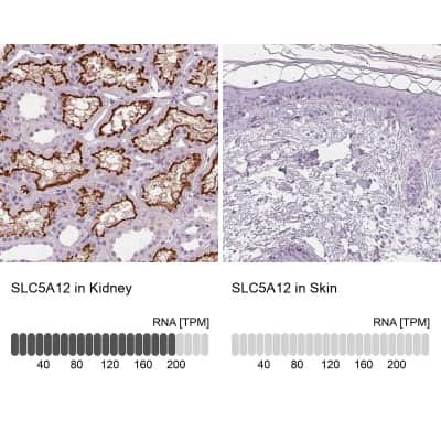 Immunohistochemistry-Paraffin: SLC5A12 Antibody [NBP2-49322]