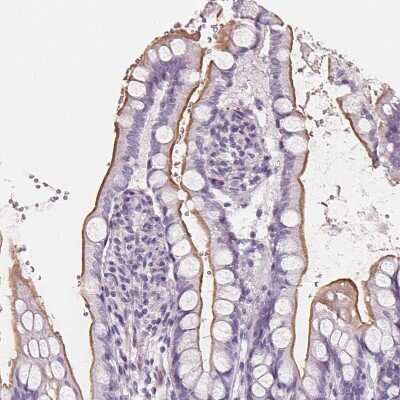 Immunohistochemistry-Paraffin: SLC5A12 Antibody [NBP2-49322]