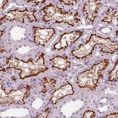 Immunohistochemistry-Paraffin: SLC5A12 Antibody [NBP2-49322]