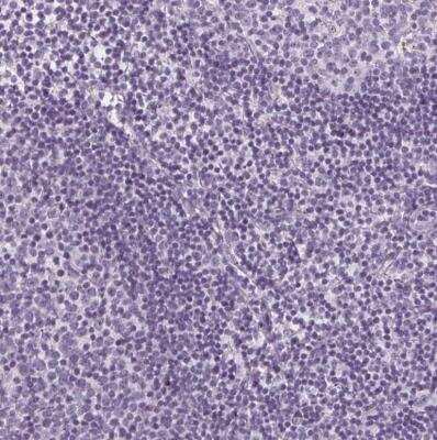 Immunohistochemistry-Paraffin: SLC5A12 Antibody [NBP2-49322]