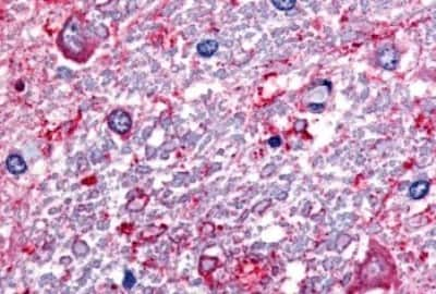 Immunohistochemistry-Paraffin: SLC5A3 Antibody [NBP3-14475]