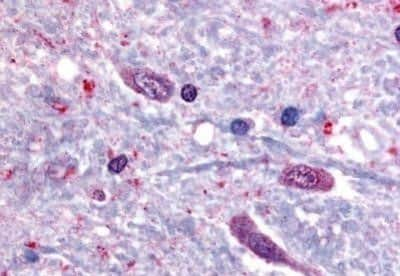 Immunohistochemistry-Paraffin: SLC5A3 Antibody - BSA Free [NBP1-02399]