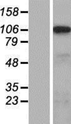 Western Blot: SLC5A3 Overexpression Lysate [NBP2-07553]