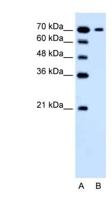 Western Blot: SGLT3/SLC5A4 Antibody [NBP1-59886]