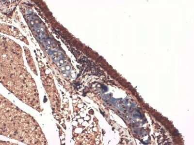 Immunohistochemistry: SLC5A5/Sodium Iodide Symporter Antibody (14F) [NBP2-59341]