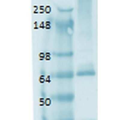 Western Blot: SLC5A5/Sodium Iodide Symporter Antibody (14F) [NBP2-59341]