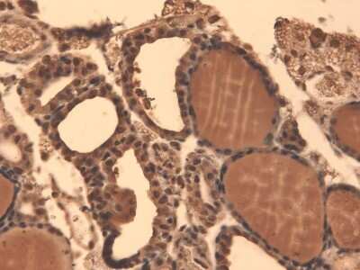 Immunohistochemistry: SLC5A5/Sodium Iodide Symporter Antibody (FP5) [NBP1-70342]