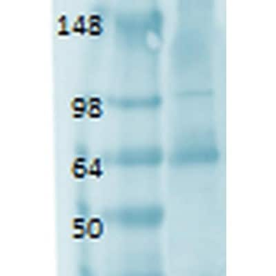 Western Blot: SLC5A5/Sodium Iodide Symporter Antibody (FP5) [NBP1-70342]